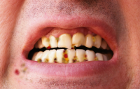 smfruitcake-teeth